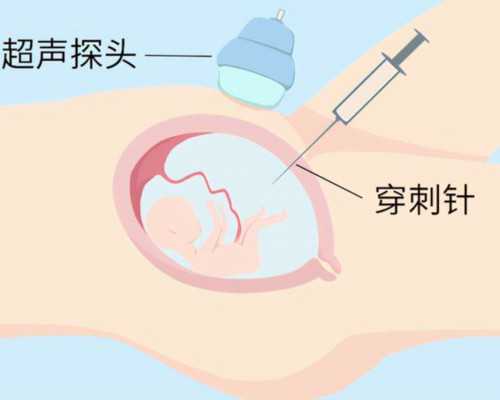 广州高成功率助孕网站,广州哪里做不孕检查比较好,广州哪家医院做得好？