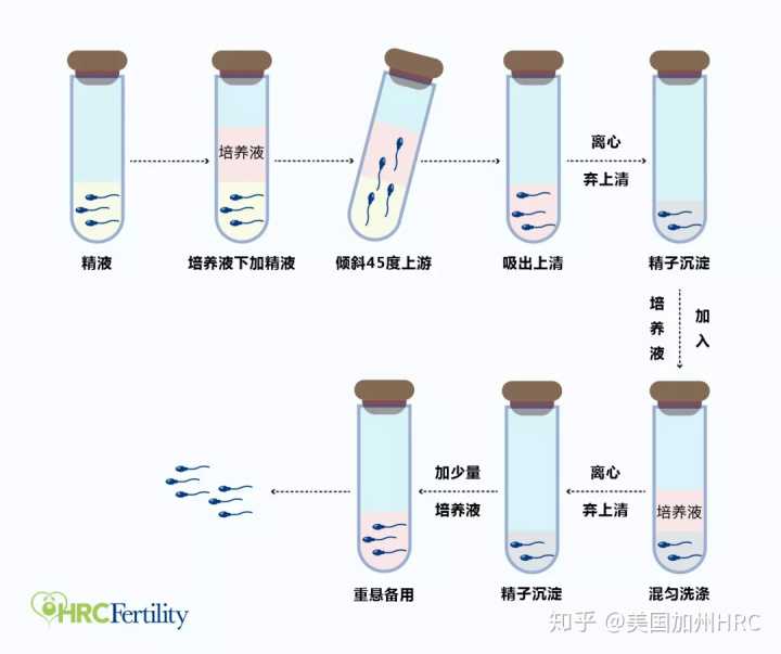 广州试管婴儿技术最好的医院是哪家,广州第三代试管婴儿多少钱