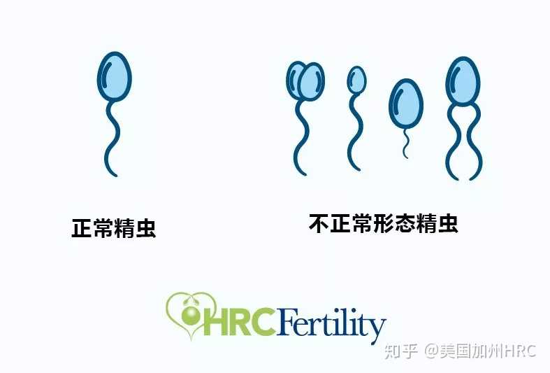 郑州单身女性精子库可以做试管婴儿吗,HRC课堂|HIV感染也可以健康生育？！辅助