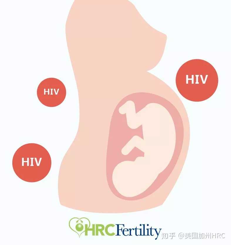 郑州单身女性精子库可以做试管婴儿吗,HRC课堂|HIV感染也可以健康生育？！辅助
