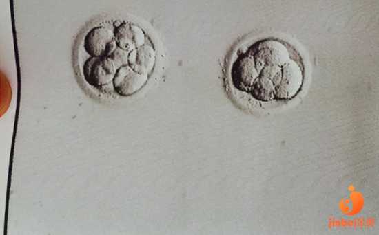 广州哪里找代孕医院,【广州地下供卵试管哪里有】顺利诞下小棉袄，讲讲我的