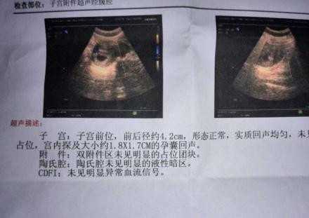 刷涂料对代孕有影响吗_广州供卵代孕多少钱