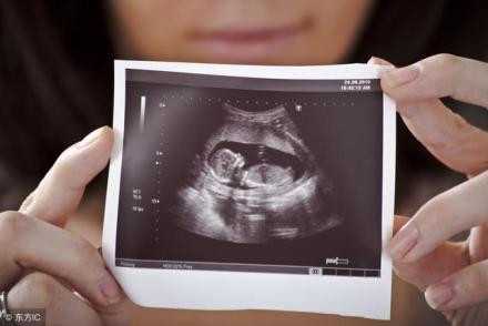 广州有代孕机够吗_广州在代孕是合法的吗_美国冻卵费用是多少：营养胎教怎么