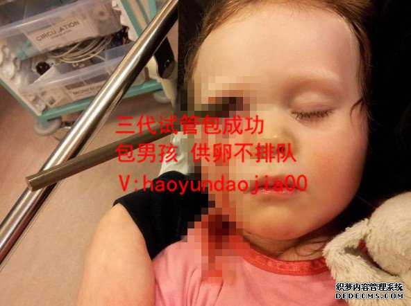 广州传承试管可靠吗_广州哪里有代妈_试管婴儿最早什么时候_试管婴儿减胎最佳