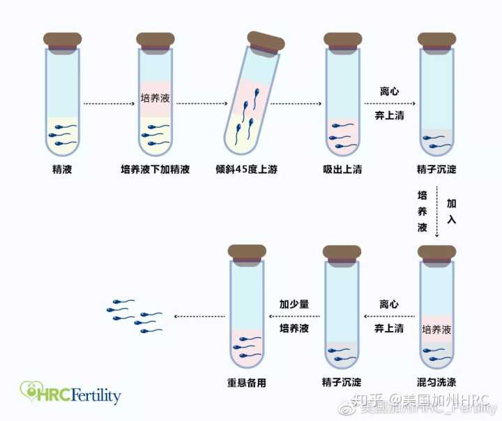 广州妇幼医院人流多少钱，不敢用药流怕疼,广州尿道生殖系统感染医院现在排
