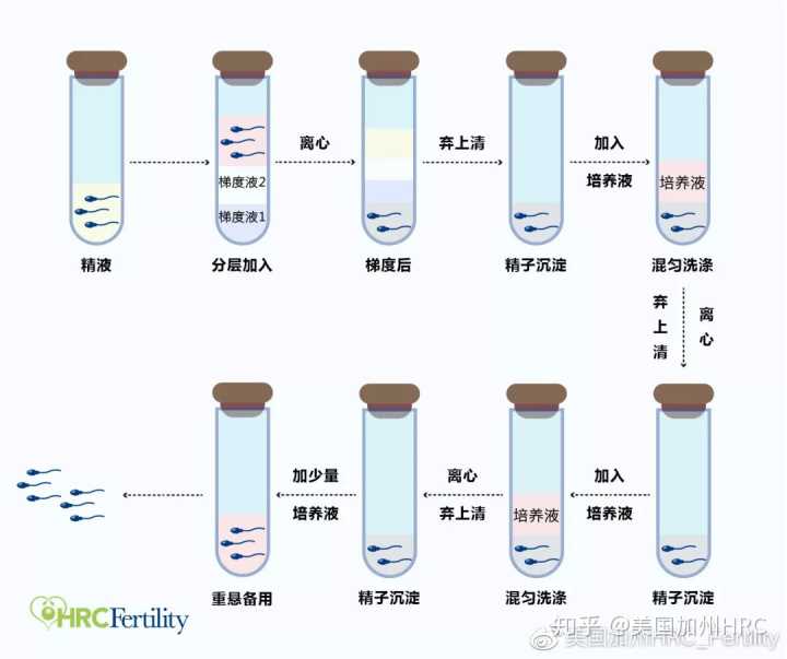 广州妇幼医院人流多少钱，不敢用药流怕疼,广州尿道生殖系统感染医院现在排